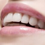 8 habits to have white teeth